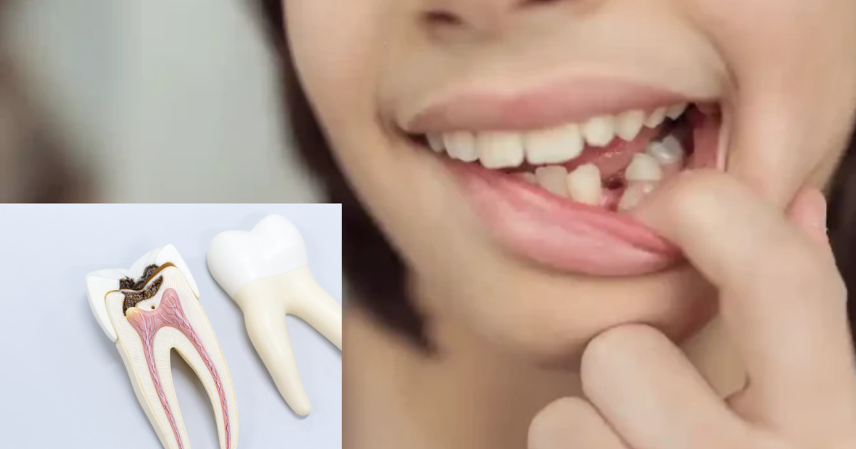 vital pulp therapy for kids