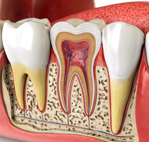  Non-Surgical Root Canal Care in Dallas