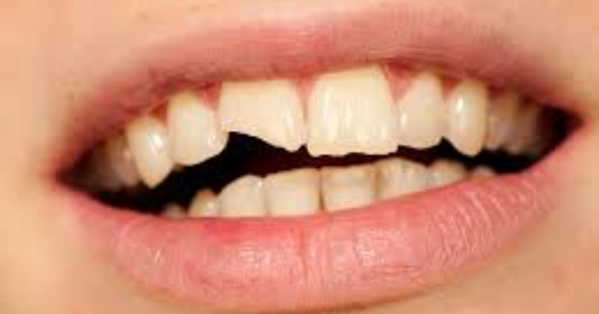 how can an endodontist restore your smile