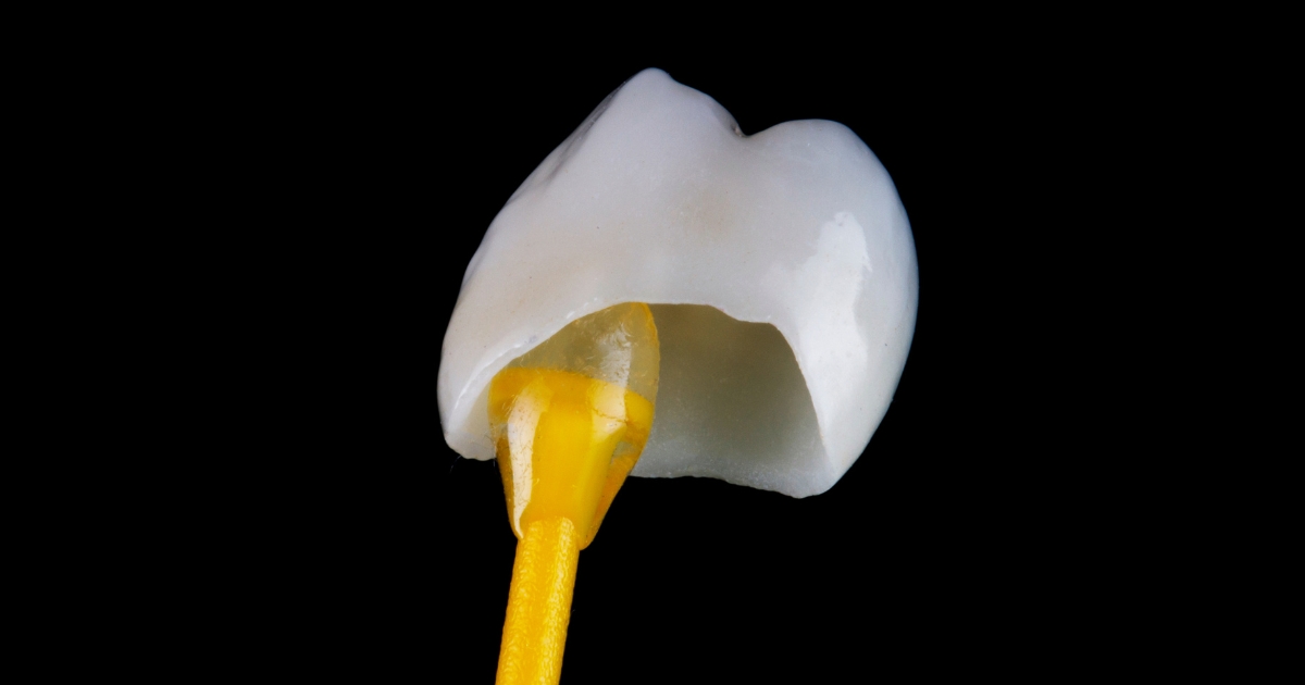 a comprehensive guide to crown lengthening techniques