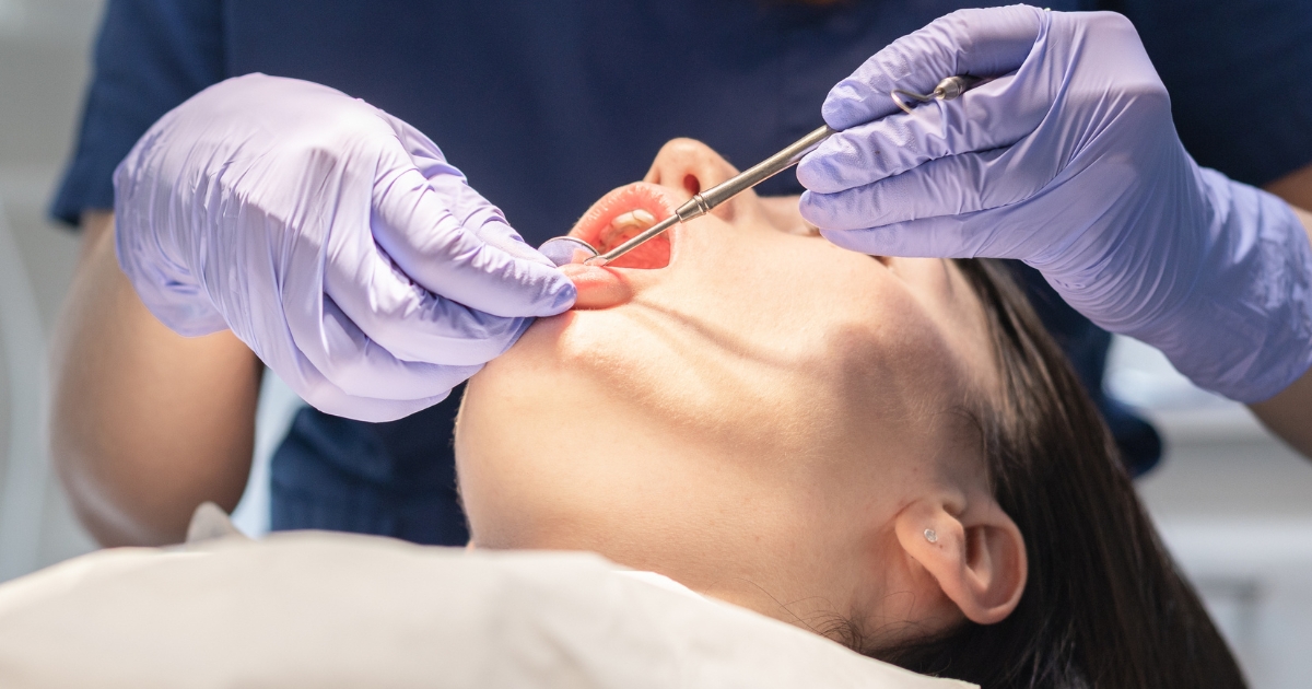 the common indications for frenectomy